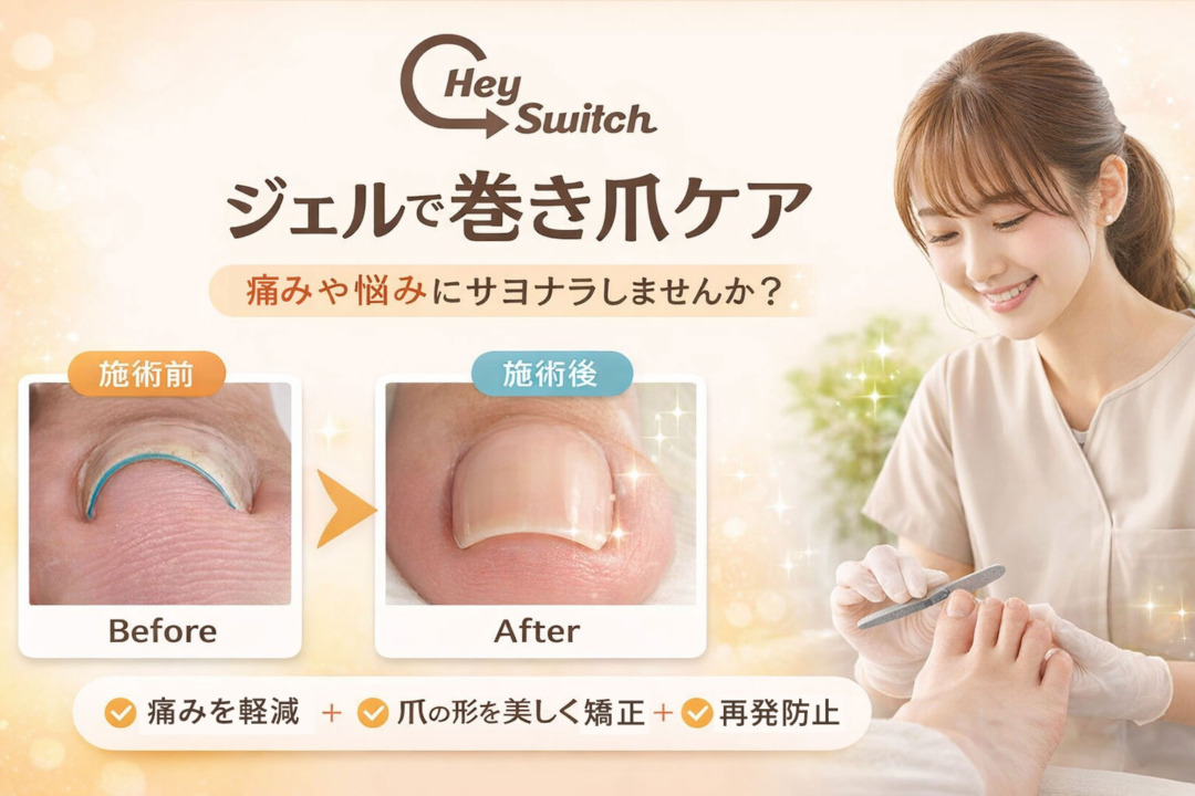 巻き爪コース 巻き爪コース